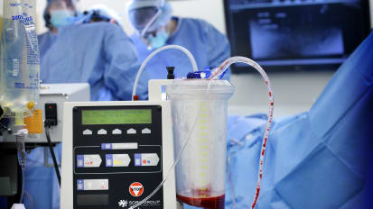 Johns Hopkins Health System Reduces Unnecessary Transfusions With New Blood Management Program