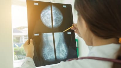 New Study Shows Young Women With Breast Cancer Who Opt for Mastectomies Report Lower Quality of Life