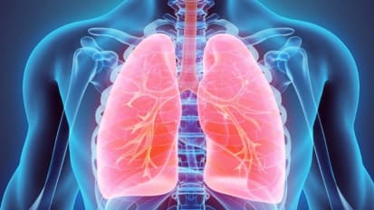 AI Helps Predict Lung Cancer Risk