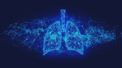 Lung Transplant Outcomes at UCSF Among the Nation’s Best 