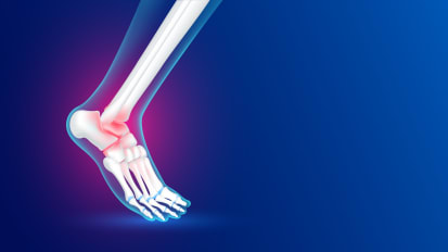 Metagenomic Next-Generation Sequencing in Osteoarticular Infections With a Focus on Pediatrics: Current Concepts and Clinical Applications