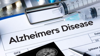 Fast Facts on Precision Medicine: Predicting Alzheimer’s Onset