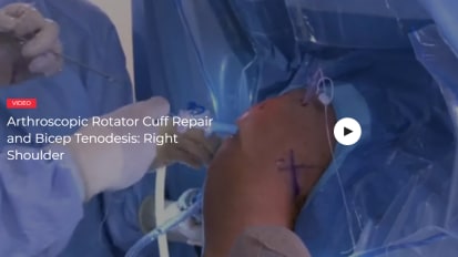 Top 10 Orthopedic Videos by BroadcastMed