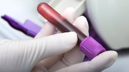Blood Test Identifies More Treatable Cancer Mutations Than Tissue Biopsy Alone