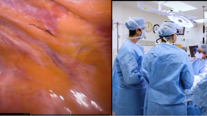 Enhancing Care for Thoracic Oncology Surgery Patients