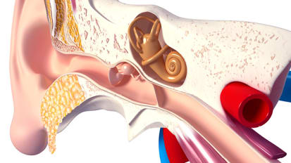 A Direct Procedure for Eustachian Tube Dysfunction