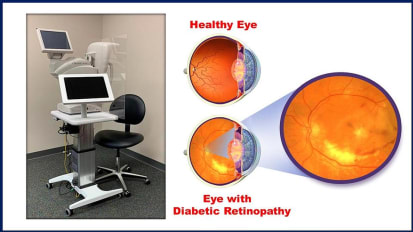 Research Story Tip: Adult-Proven ‘Smart’ Diagnostic Tool for Diabetic Retinopathy Also Works for Kids