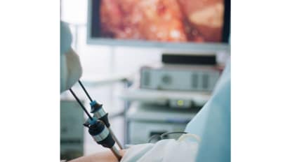 Minimally Invasive Surgery Options for Gynecologic Surgeries