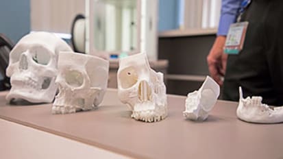 3D printing becoming a surgical game changer