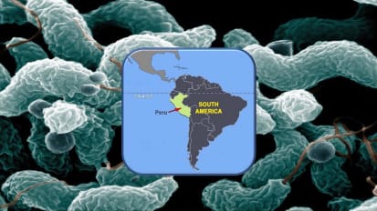 Johns Hopkins Medicine Helps Find Cause of Guillain-Barre Syndrome Outbreak in Peru