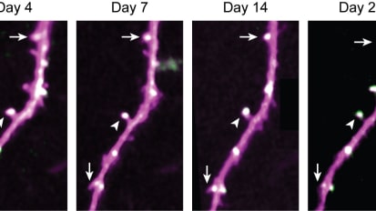 In Mice, Long-Lasting Brain Proteins Offer Clues to How Memories Last a Lifetime