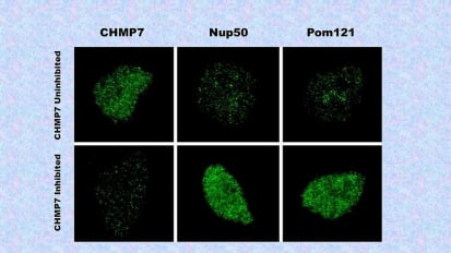 Johns Hopkins Medicine Suggests Eliminating Nerve Cell Protein May Stop ALS, Dementia