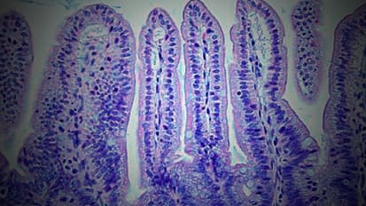 Leading Transformative Change in Graft-Versus-Host Disease Research