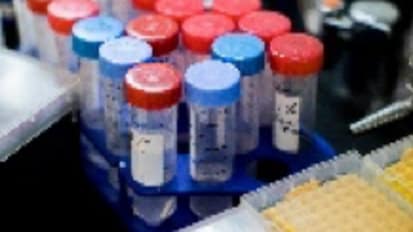 “Liquid Biopsy” for Advanced Prostate Cancer Spots Tiny Danger Signs Sooner