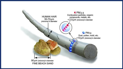 Research Story Tip: Johns Hopkins Medicine Researchers Show How Air Pollution May Contribute to Loss of Smell