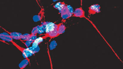 Road to Cell Death More Clearly Identified for Parkinson’s Disease