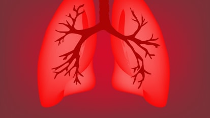 Yale Medicine’s Pulmonary Vascular Disease Program
