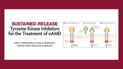 Sustained-release Tyrosine Kinase Inhibitors for the Treatment of nAMD