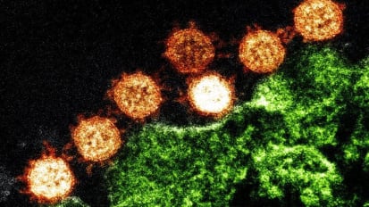 As Mysterious Coronavirus Spreads, An Infectious Disease Expert Explains What You Should Know