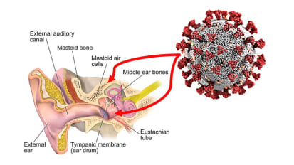 COVID-19 Story Tip: Have You Heard? Middle Ear, Mastoid Harbor Sars-Cov-2 and May Pose Risk for Medical Staffs