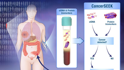 Single Blood Test Screens for Eight Cancer Types