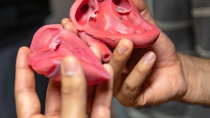 3D Cardiovascular Simulation Lab Revolutionizes Heart Surgery