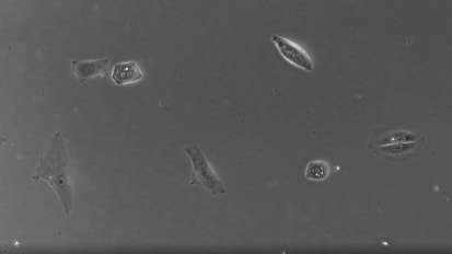 Surgical Transplantation of Human RPE Stem Cell-Derived RPE Monolayers into Non-Human Primates with Immunosuppression