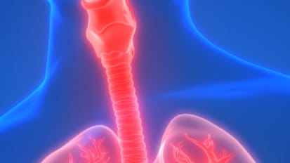 Constructing a New Trachea to Avoid Permanent Tracheostomy