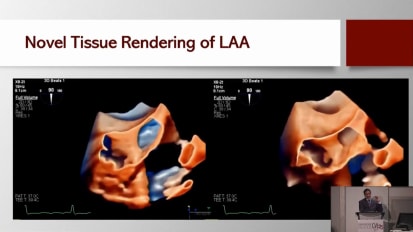 Advances in Echocardiography Imaging: AI and Beyond