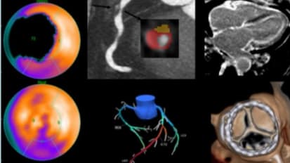 Advances in Nuclear Cardiology, Cardiac CT and Cardiac MRI: 36th Annual Case Review with the Experts