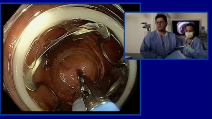 2019 LI Live: Live Endoscopic Procedures - Afternoon Part 2 of 2