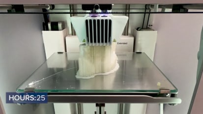 3D Printing: A Surgical Game Changer - Timelapse of 3D Printing Process