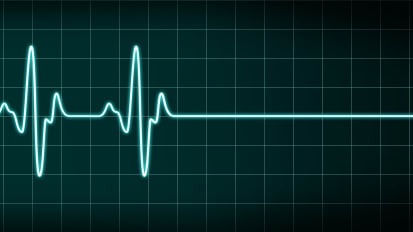 The Epidemiology of Heart Failure