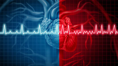 Advanced Treatment of Atrial Fibrillation