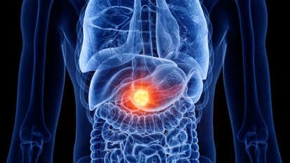 Advances in Pancreatic Surgery