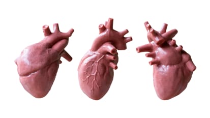 Single Ventricle Patients: Half the Heart but Twice the Problems?