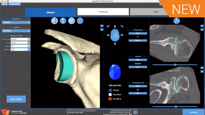 Pre-Operative Planning & Virtual Surgery: Augmented Anatomic Complex Case Debate [CAW 9025]