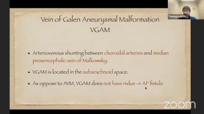 Vein of Galen Malformation Update
