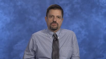 What length of time is typically required to determine whether ECP has been effective for cGVHD, and when might you consider discontinuation of ECP based on a clinical response to ECP? What is the accepted tapering schedule in responders?