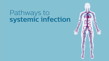 Pathways to systemic infection