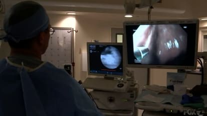 Non-invasive Approach to Esophageal Cancer