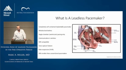 Evolving Role in Leadless Pacemakers in the Peri-Operative Period