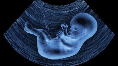 Fetal Therapy for Best Beginnings