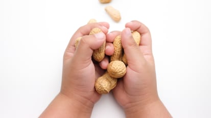 Peanut Allergy | Podcast