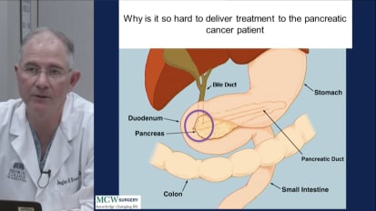 Staging, Treatment Sequencing, and Personalized Medicine for Localized Pancreatic Cancer: The Medical College of Wisconsin Experience, Douglas B. Evans, MD