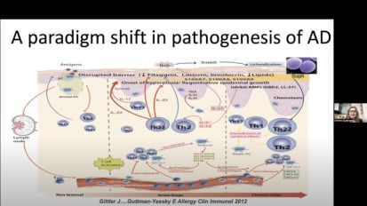 “Inflammatory Skin Diseases: The Translational Revolution” by Emma Guttman-Yassky, MD, PhD