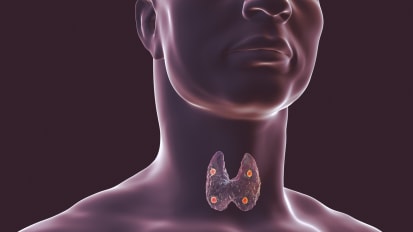 Primary Hyperparathyroidism: A Multidisciplinary Case Review