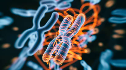 Alpha-One Antitrypsin Deficiency and Ascending Aortic Distention