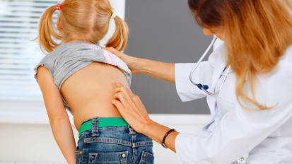 Optimizing Treatment for Scoliosis