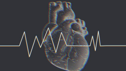 Current Perspective of Cardiogenic Shock in 2023 From New Definitions to New Devices